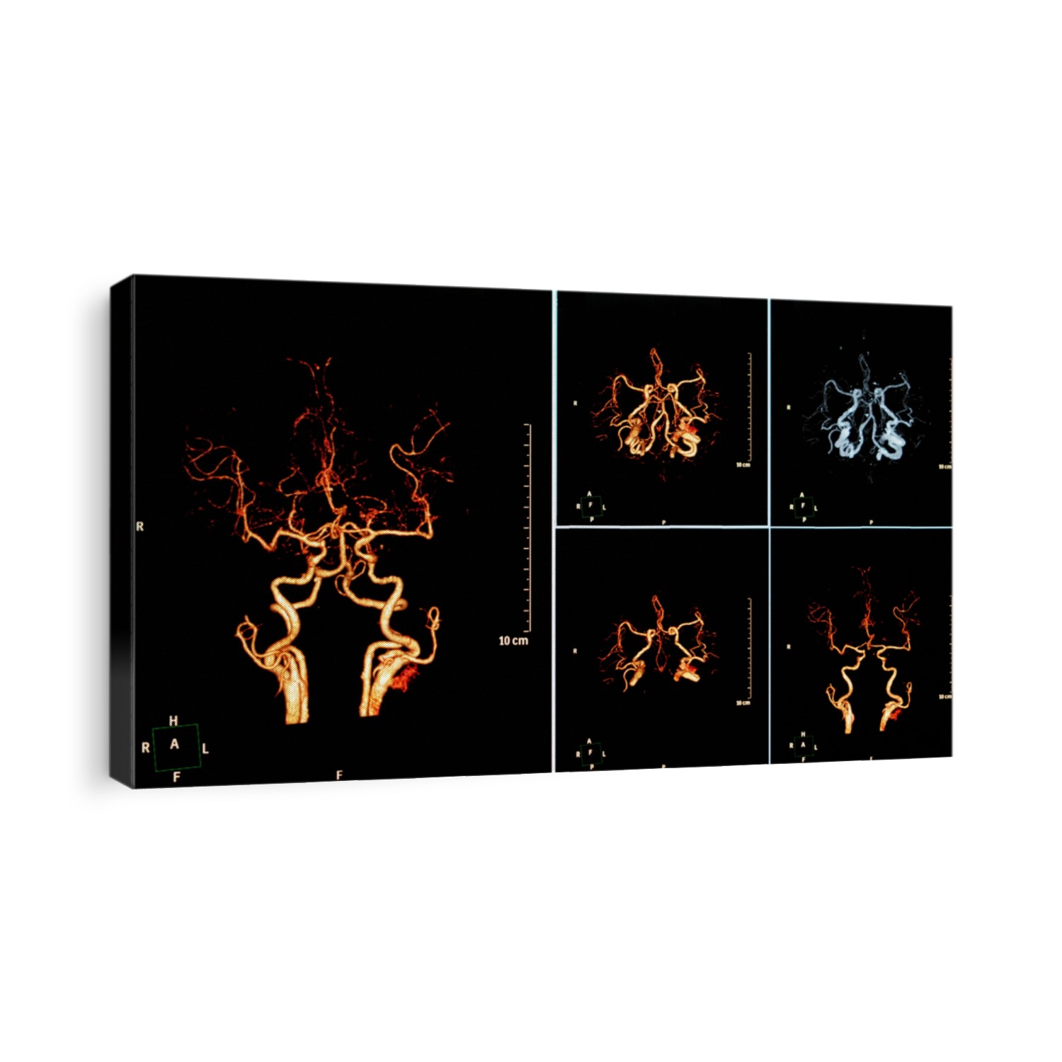  CT Scan Brain , CTA Brain , Film X-ray                                